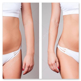 Miglioramento acne: prima e dopo