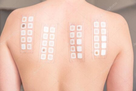 Valutazione di tollerabilità cutanea durante patch test
